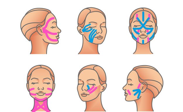 kinesiology taping illustrations on face